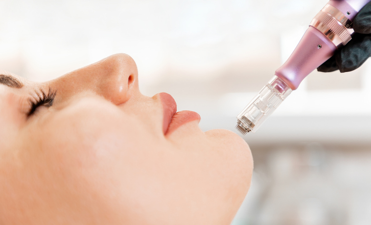 Beauty treatment and professional cosmetology. Rejuvenation procedure of fractional mesotherapy of the face to the client. Close up of female chin